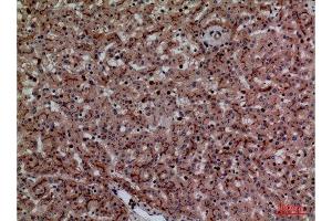 Immunohistochemistry (IHC) analysis of paraffin-embedded Human Liver, antibody was diluted at 1:100. (CEACAM1/5 antibody  (N-Term))