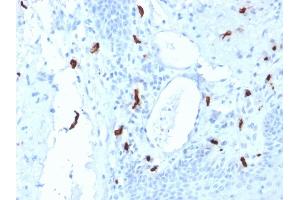 Formalin-fixed, paraffin-embedded human Tonsil stained with Tryptase Mouse Monoclonal Antibody (TPSAB1/1961). (TPSAB1 antibody  (AA 115-233))
