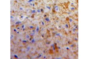 IHC-P analysis of Brain tissue, with DAB staining. (Apelin antibody  (AA 24-77))
