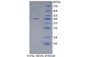 SDS-PAGE analysis of Mouse Apolipoprotein F Protein. (Apolipoprotein F Protein (APOF))