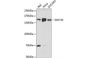 Western blot analysis of extracts of various cell lines using GM130 Polyclonal Antibody at dilution of 1:1000. (Golgin A2 (GOLGA2) antibody)