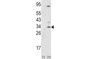 Western blot analysis of SNAI1 antibody and 293 cell lysate (2 ug/lane) either nontransfected (Lane 1) or transiently transfected with the SNAIL gene (2). (SNAIL antibody  (AA 1-30))