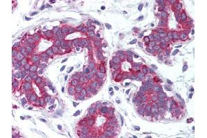 Image no. 1 for anti-Tumor Necrosis Factor (Ligand) Superfamily, Member 11 (TNFSF11) antibody (ABIN302887) (RANKL antibody)