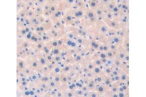 #VALUE! (TSSK1 antibody  (AA 57-314))