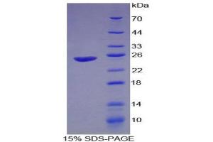 SDS-PAGE (SDS) image for Interferon alpha (IFNA) (AA 1-187) protein (His tag) (ABIN2125369)