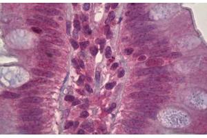 Anti-MAPK8 / JNK1 antibody IHC staining of human small intestine. (JNK antibody)