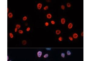 Immunofluorescence analysis of HeLa cells using p21 Polyclonal Antibody at dilution of 1:100. (p21 antibody)