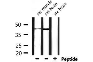 Western blot analysis of extracts from rat muscle and rat brain, using CHST14 Antibody. (CHST14 antibody  (Internal Region))