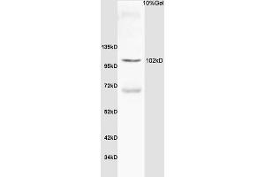Rat thyroid lysate probed with Anti Thyroid peroxidase Polyclonal Antibody, Unconjugated (ABIN668736) at 1:200 overnight at 4 °C. (Thyroperoxidase antibody  (AA 351-450))