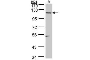 WB Image A: 30 ug of 293T nuclear extract (TSHZ1 antibody)