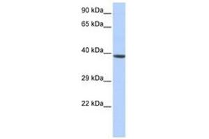 Image no. 1 for anti-Homeobox A2 (HOXA2) (C-Term) antibody (ABIN6740559)