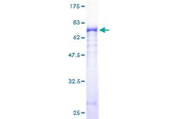 Gasdermin B Protein (GSDMB) (AA 1-411) (GST tag)