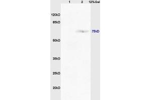 Lane 1: mouse intestine lysates Lane 2: mouse lung lysates probed with Anti TAP2/ABCB3 Polyclonal Antibody, Unconjugated (ABIN680123) at 1:200 in 4 °C.