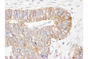 Immunohistochemistry (IHC) image for anti-Protein Disulfide Isomerase Family A, Member 6 (PDIA6) (AA 250-300) antibody (ABIN7453940) (PDIA6 antibody  (AA 250-300))
