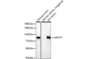 Western blot analysis of extracts of various cell lines, using NPHP1 antibody (ABIN7268847) at 1:1000 dilution. (NPHP1 antibody)