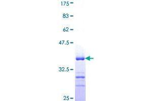 Image no. 1 for Filamin Binding LIM Protein 1 (FBLIM1) (AA 270-373) protein (GST tag) (ABIN1353694) (FBLIM1 Protein (AA 270-373) (GST tag))