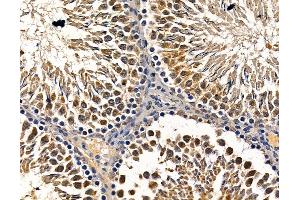 ABIN7094978 and ABIN7099034 at 1/100 staining rat testis tissue by IHC-P.