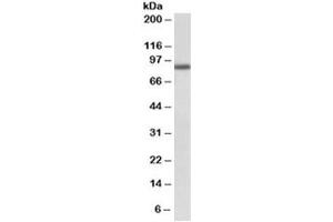 Western blot testing of A549 lysate with FGFR1 antibody at 1ug/ml. (FGFR1 antibody)