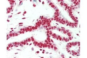 Anti-SMC1A / SMC1 antibody IHC staining of human breast. (SMC1A antibody  (C-Term))