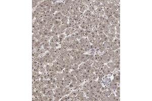 Immunohistochemical analysis of C on paraffin-embedded Human liver tissue. (Cyclin Y antibody  (AA 140-169))