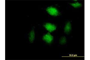 Immunofluorescence of purified MaxPab antibody to CLIC3 on HeLa cell.