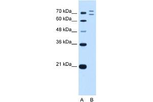 WB Suggested Anti-RNF168 Antibody Titration:  0.