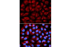 Immunofluorescence analysis of U2OS cells using FANCC antibody. (FANCC antibody)