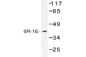 Western blot (WB) analysis of SR-1E antibody in extracts from HeLa cells.