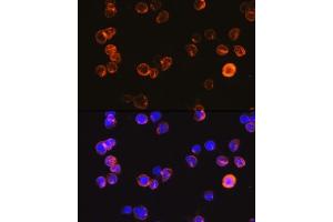 Immunofluorescence analysis of Jurkat cells using CD3E Antigen antibody (ABIN6134272, ABIN6138181, ABIN6138184 and ABIN6216032) at dilution of 1:100.