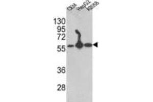 Western Blotting (WB) image for anti-Prolyl 4-Hydroxylase, beta Polypeptide (P4HB) antibody (ABIN3001707)