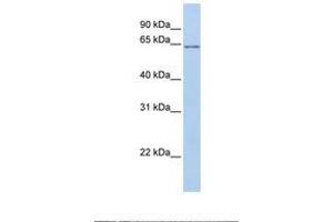 Image no. 1 for anti-Angiopoietin-Like 2 (ANGPTL2) (AA 72-121) antibody (ABIN6739008) (ANGPTL2 antibody  (AA 72-121))