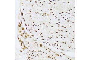 Immunohistochemistry (Paraffin-embedded Sections) (IHC (p)) image for anti-Acidic (Leucine-Rich) Nuclear phosphoprotein 32 Family, Member A (ANP32A) (AA 1-170) antibody (ABIN6136909)