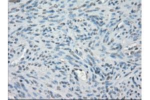 Immunohistochemical staining of paraffin-embedded Ovary tissue using anti-PPP5Cmouse monoclonal antibody.