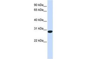 Image no. 1 for anti-Protein FAM164B (ZC2HC1B) (C-Term) antibody (ABIN6741093) (FAM164B antibody  (C-Term))