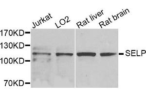 Western blot analysis of extracts of various cells, using SELP antibody. (P-Selectin antibody)