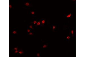 ABIN6266740 staining HeLa cells by IF/ICC. (Tspan-8 antibody  (Internal Region))