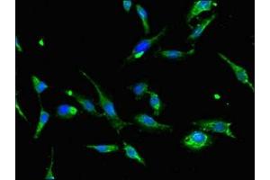 Immunofluorescent analysis of Hela cells using ABIN7144507 at dilution of 1:100 and Alexa Fluor 488-congugated AffiniPure Goat Anti-Rabbit IgG(H+L) (AQP2 antibody  (AA 225-271))