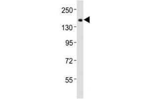 Western blot testing of Tet1 antibody at 1:2000 dilution + F9 lysate (TET1 antibody  (C-Term))