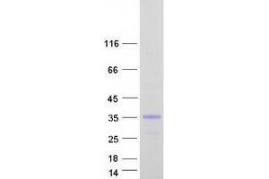 Validation with Western Blot