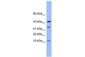 CASP6 antibody used at 0. (Caspase 6 antibody  (Middle Region))