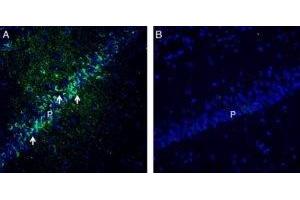 Expression of PACSIN1 in rat hippocampus. (PACSIN1 antibody  (Intracellular))
