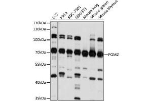 Western blot analysis of extracts of various cell lines, using PGM2 antibody.