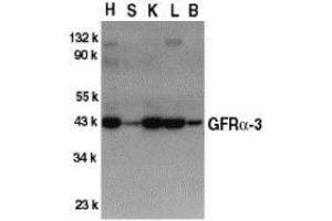 Western blot analysis of GFR alpha 3 in crude cell membrane fractions of mouse heart (H), spleen (S), kidney (K), liver (L), and brain (B), respectively, with AP30363PU-N GFR alpha 3 antibody at 1/500 dilution. (GFRA3 antibody  (Intermediate Domain))