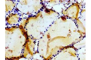 Immunohistochemistry of paraffin-embedded human thyroid tissue using ABIN7153969 at dilution of 1:100 (GRIK1 antibody  (AA 675-834))