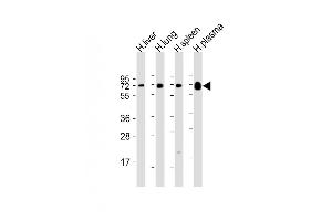 PLA2G7 抗体  (AA 200-228)