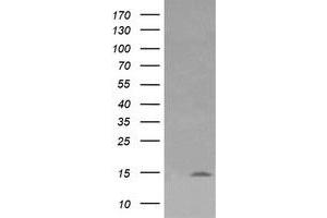 Image no. 1 for anti-Lysozyme (LYZ) antibody (ABIN1499236) (LYZ antibody)