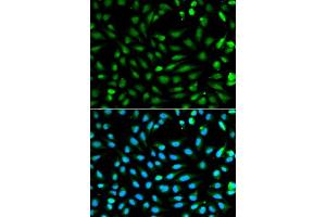 Immunofluorescence analysis of A549 cell using PCNA antibody. (PCNA antibody  (AA 1-261))