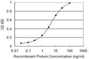 Detection limit for recombinant GST tagged SIRT1 is 0. (SIRT1 antibody  (AA 456-555))