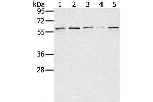 Western Blot analysis of Lovo, hela, K562, Raji and hepg2 cell using SESN1 Polyclonal Antibody at dilution of 1:200 (SESN1 antibody)