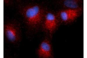 Immunofluorescence (IF) image for anti-Centromere Protein B (CENPB) antibody (PE) (ABIN5567026) (CENPB antibody  (PE))
